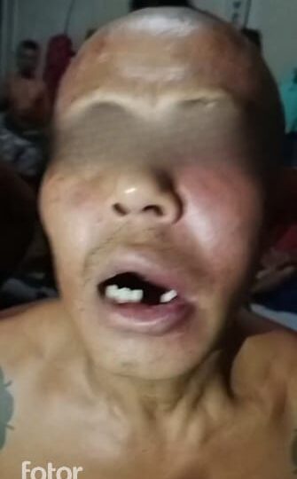 (Diduga) Oknum Petugas Pukul Warga Binaan Rutan Kelas II B Bengkayang