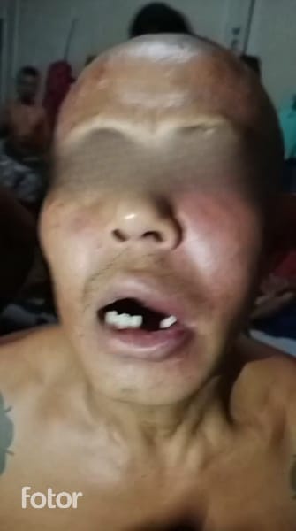 (Diduga) Oknum Petugas Pukul Warga Binaan Rutan Kelas II B Bengkayang