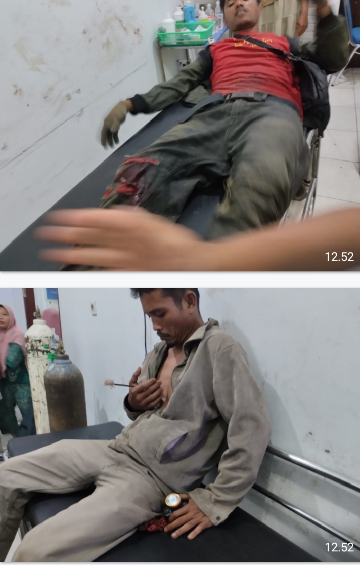 Dua Warga Terluka Kena Panah