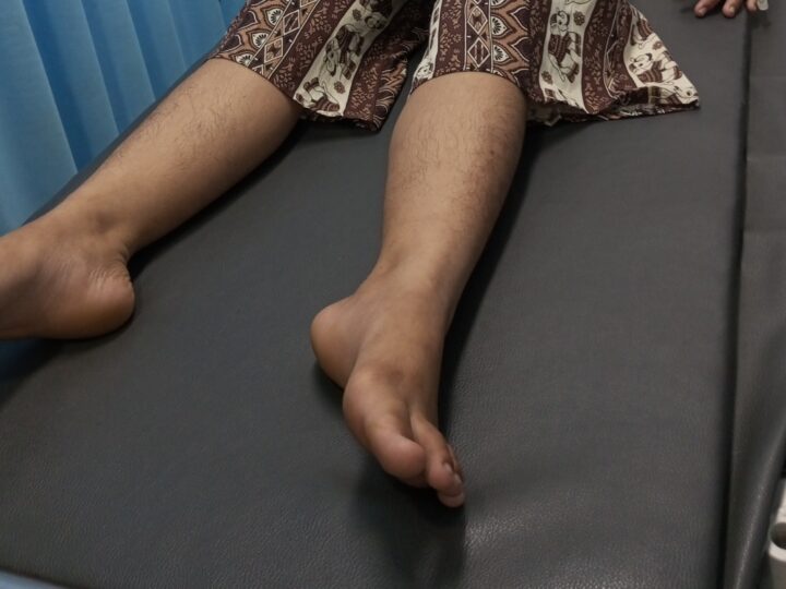 Depresi Akibat Rudapaksa, Bunga Nekat Minum Racun