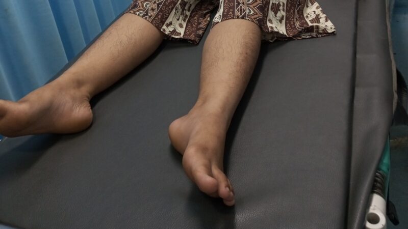 Depresi Akibat Rudapaksa, Bunga Nekat Minum Racun