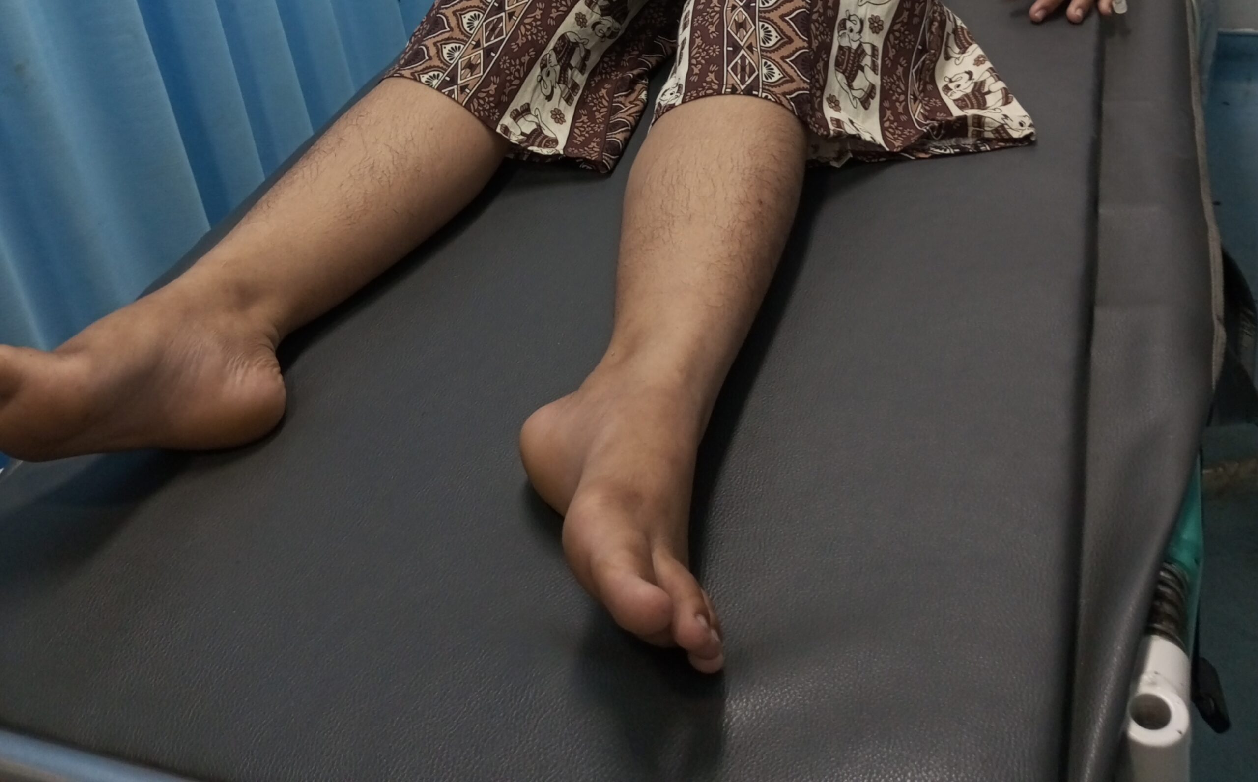 Depresi Akibat Rudapaksa, Bunga Nekat Minum Racun