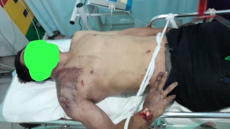 Pelaku Tabrak Lari di Dusun Kase Jelimpo Terungkap, Polisi Amankan Sopir dan Mobil Box