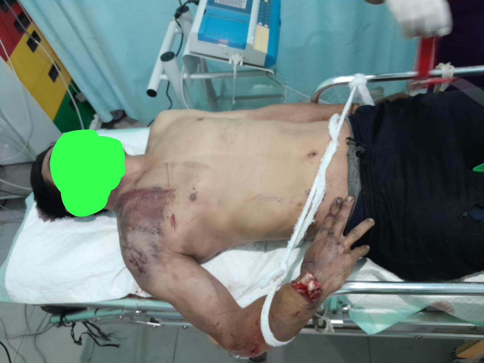 Pelaku Tabrak Lari di Dusun Kase Jelimpo Terungkap, Polisi Amankan Sopir dan Mobil Box